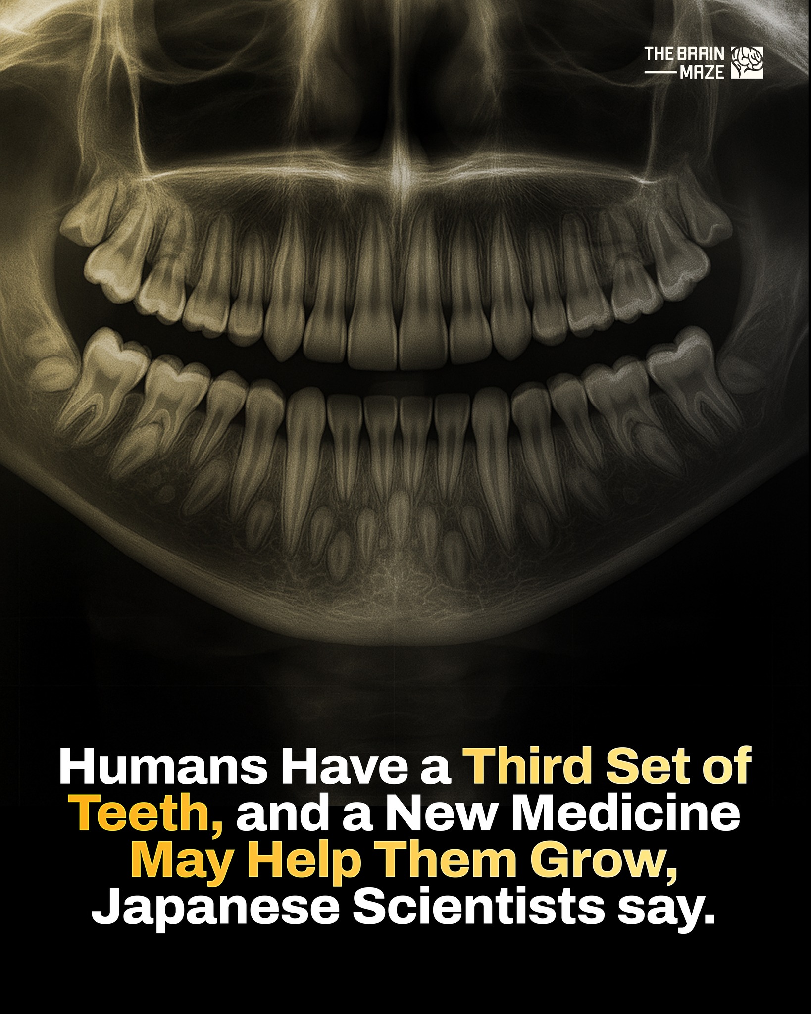 The Brain - Recent research in Japan has brought renewed attention to ...