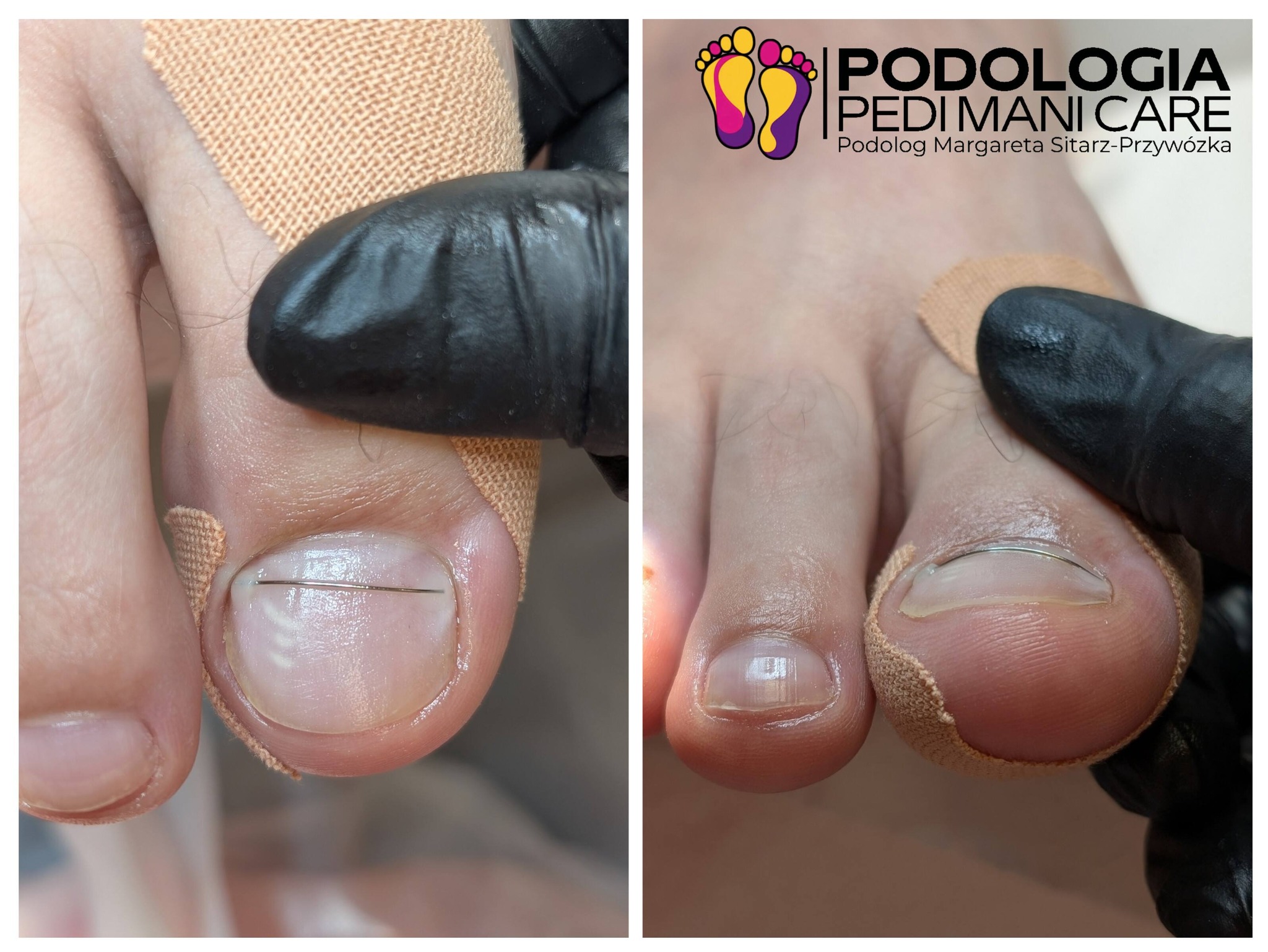Podologia PEDI MANI CARE | Sokołów Podlaski gmina
