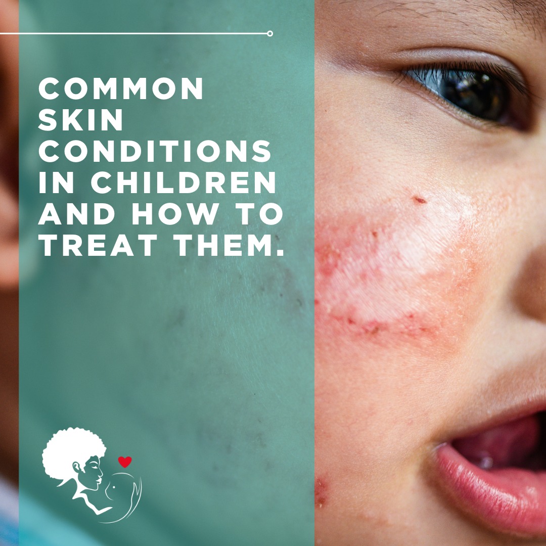 Dr - 🌟 Taking care of your child's skin involves recognising common ...