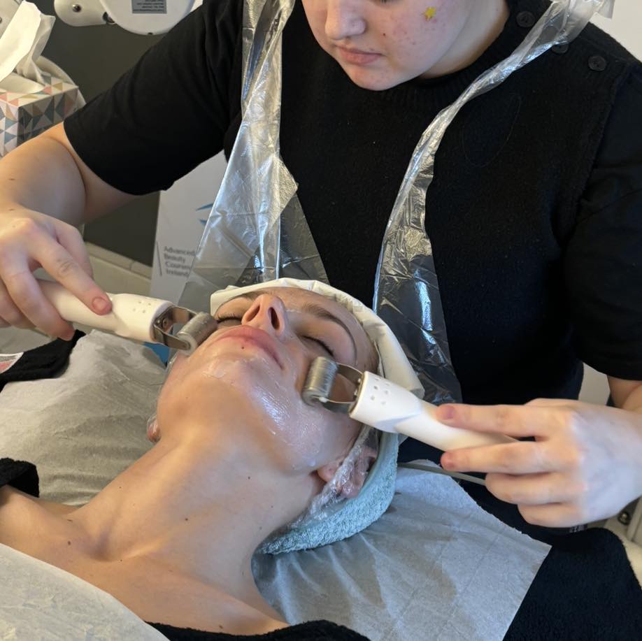 Advanced - MICRONEEDLING This treatment is also known as collagen ...