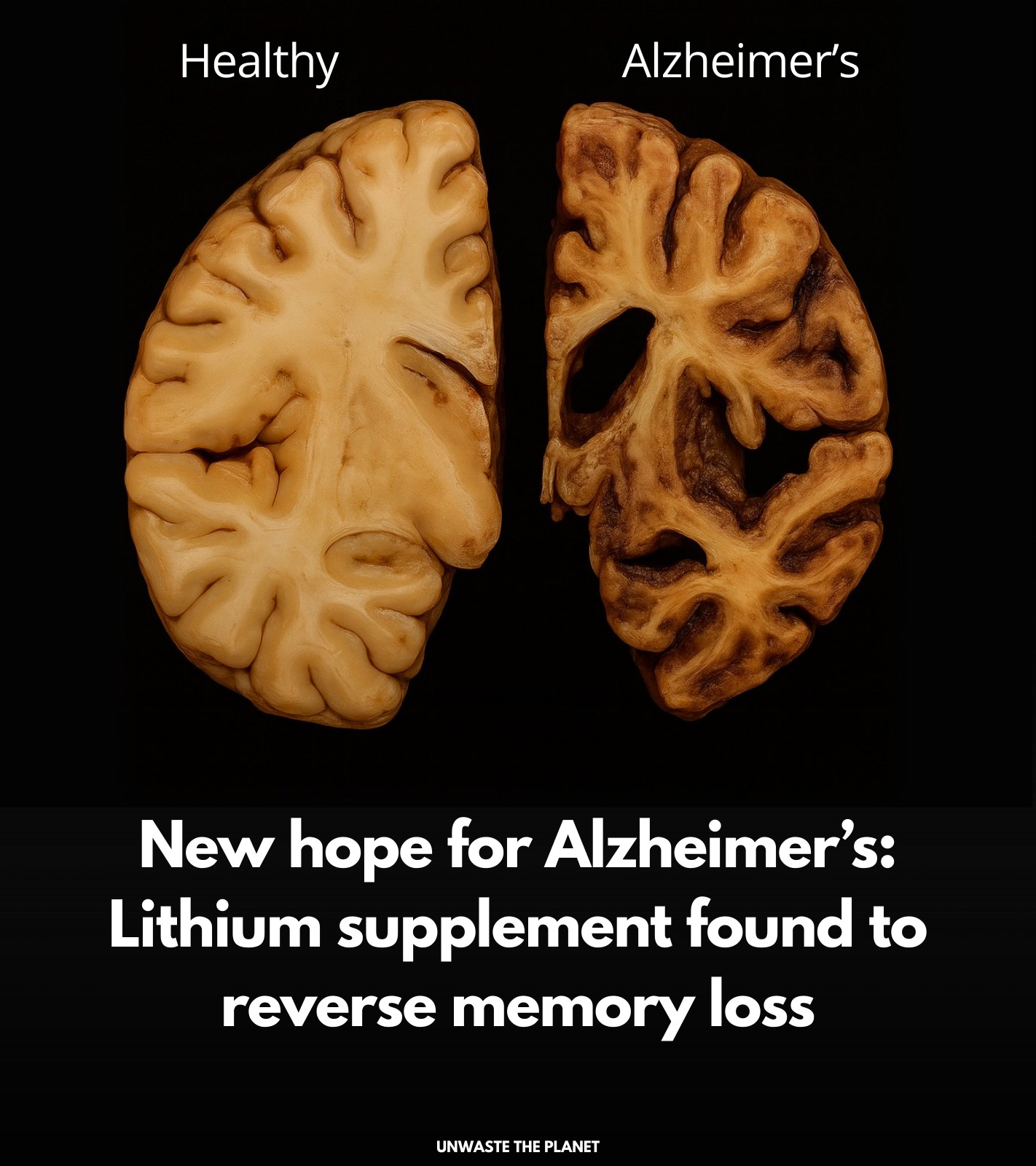 Unwaste - 🚨 A breakthrough in Alzheimer’s research: Scientists found ...
