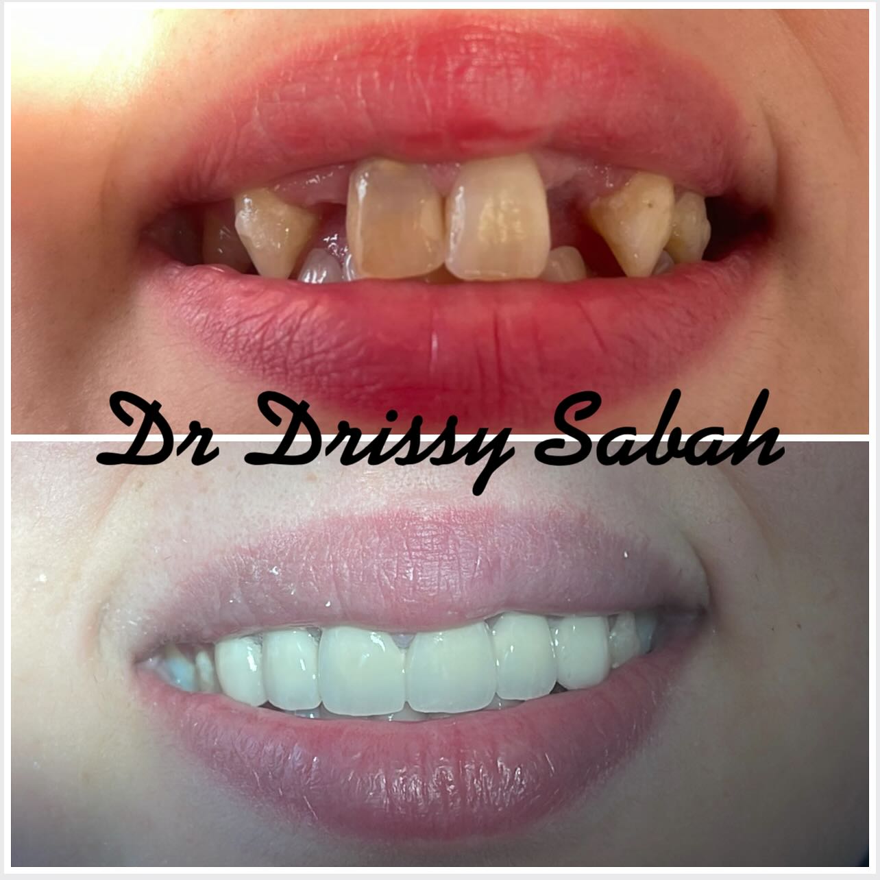 Cabinet dentaire Dr.Drissy Sabah | Rabat