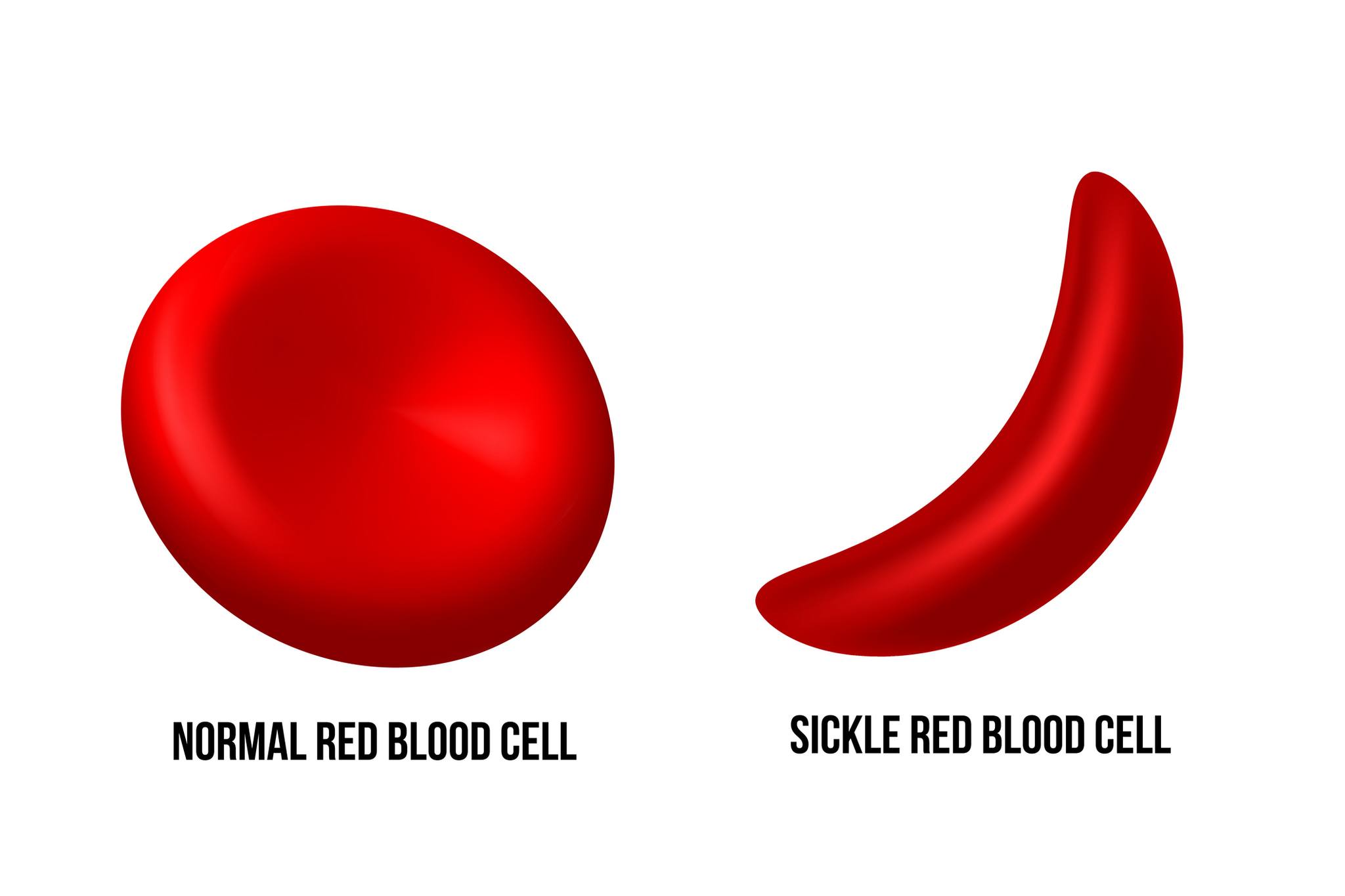 AmeriHealth - Sickle cell disease (SCD) is the most commonly inherited ...