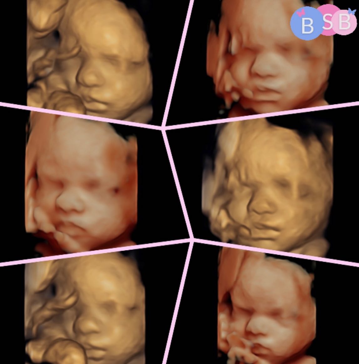 4D Bonding & Wellbeing Scan👶🏼... - Baby Scanning Boutique | Facebook