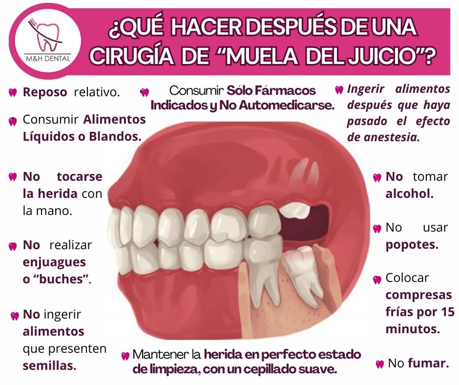 MyH - 🦷¿Sabes cuáles son los cuidados después de la extracción de las ...