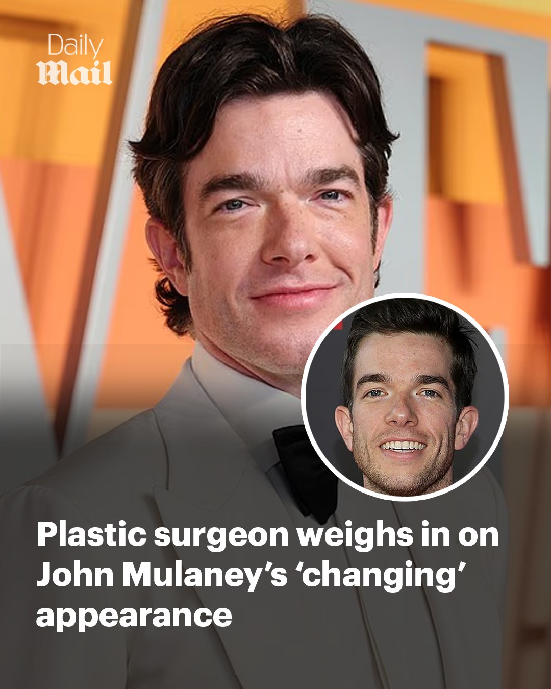 john mulaney plastic surgery Image 4