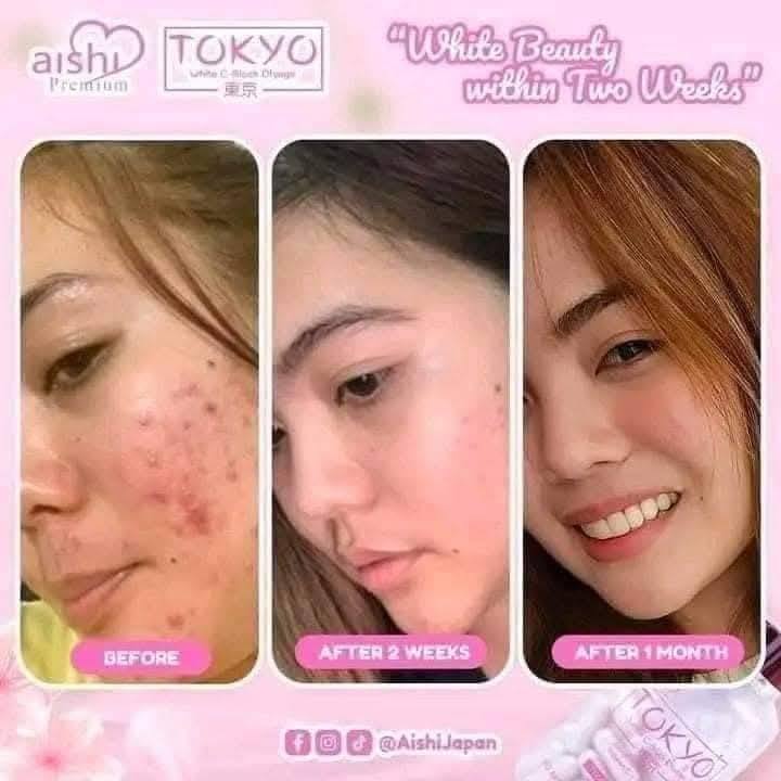 glutathione comprime super fort Glutathione Comprime Super Fort Strong Whitening Face Cream