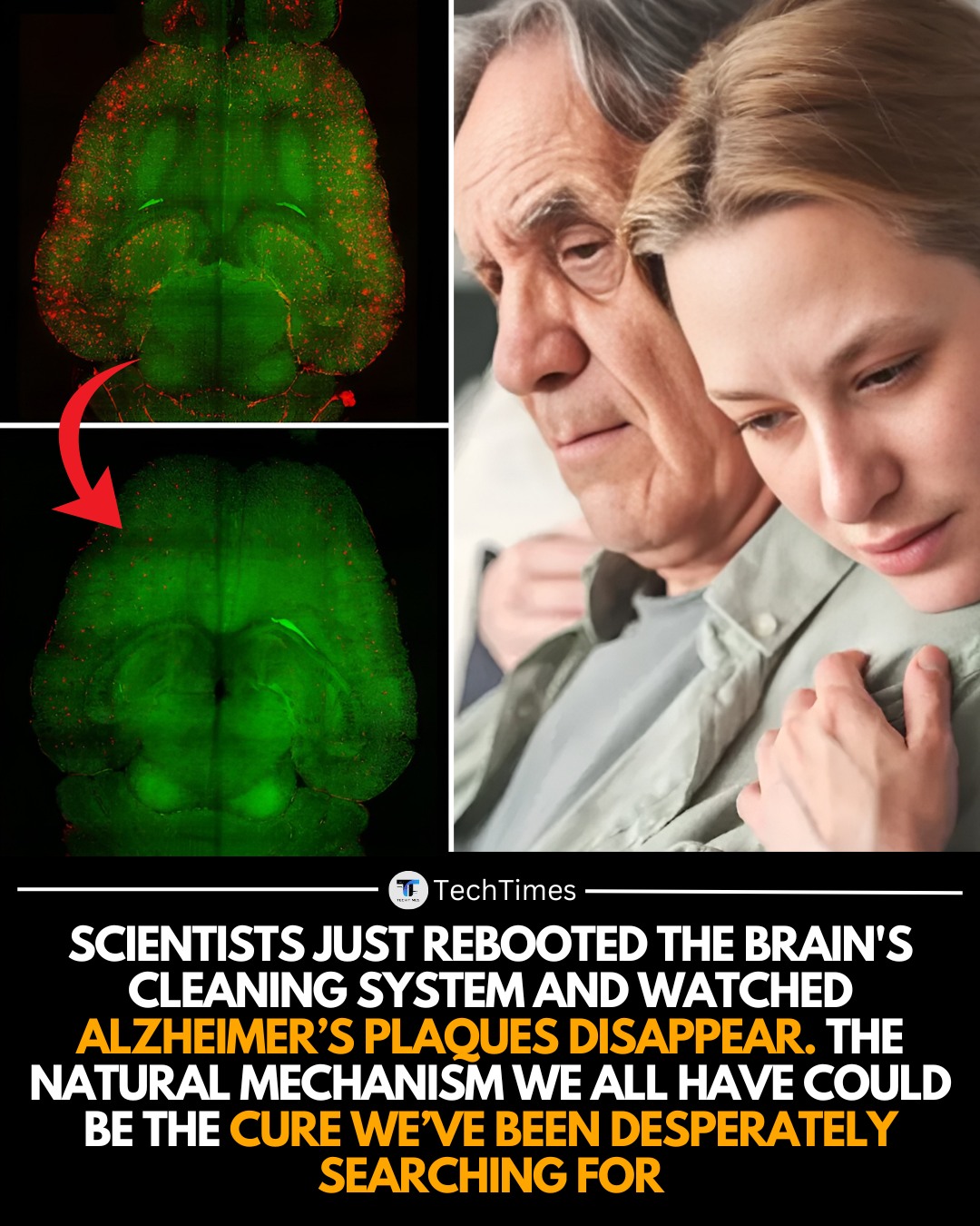 TechTimes - For decades, scientists have known the brain has its own ...