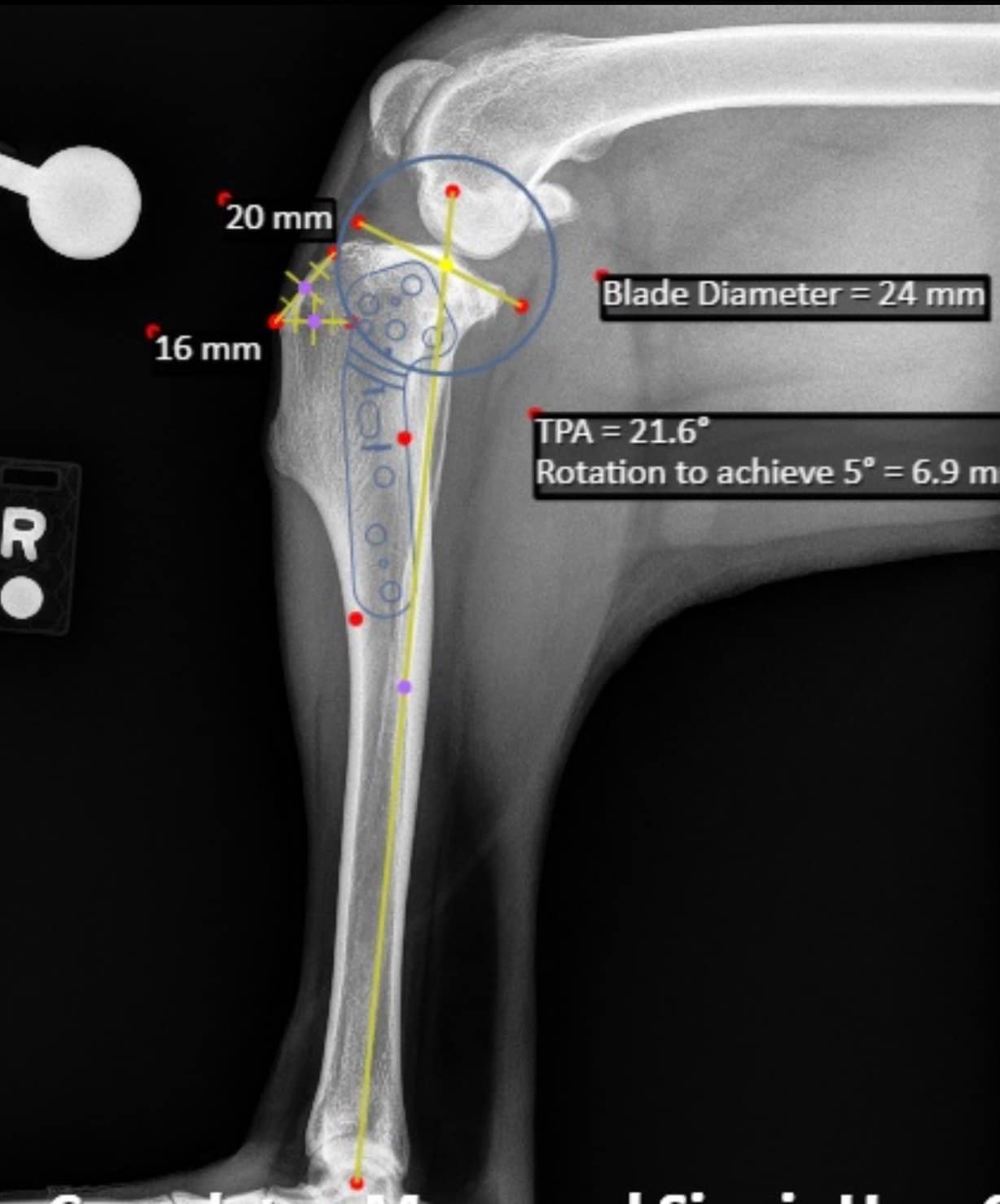 Vantage - Pre-op planning of a TPLO. The TPA is the slope of the top of ...