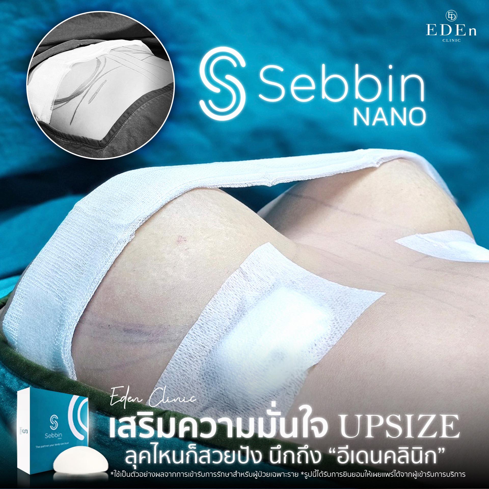 อีเดนคลินิก - จากแบนแบบแฟลต กลมละมุนแบบฟีลนางเอก อกใหม่ Sebbin Nano จาก ...