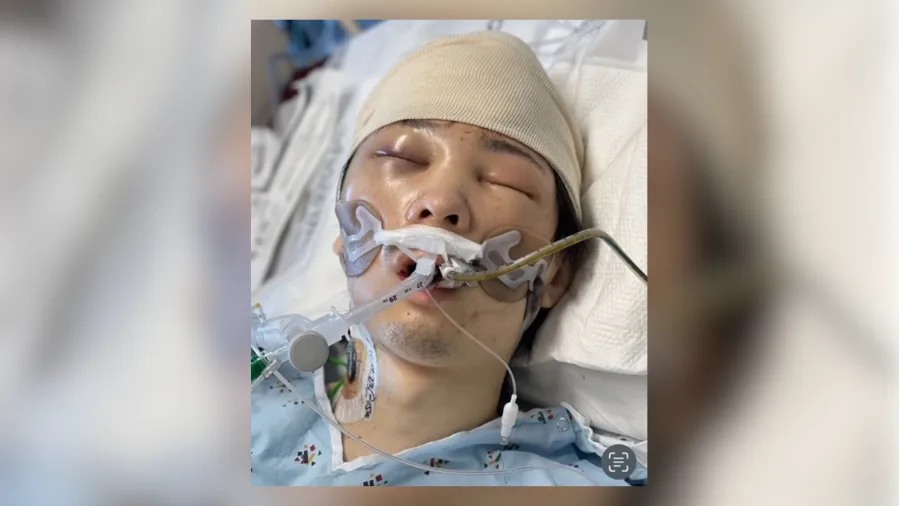 Unidentified Asian man found with traumatic brain injury in San