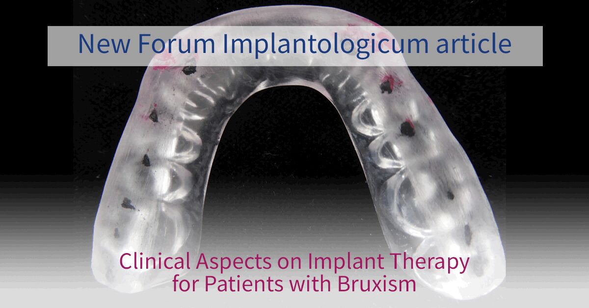 ITI International Team for Implantology - Bruxism is a widespread ...