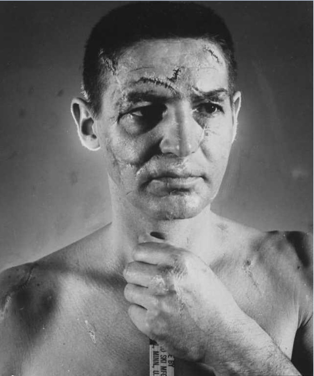Quinton - This face belongs to Terry Sawchuk, 36, goalie for the ...