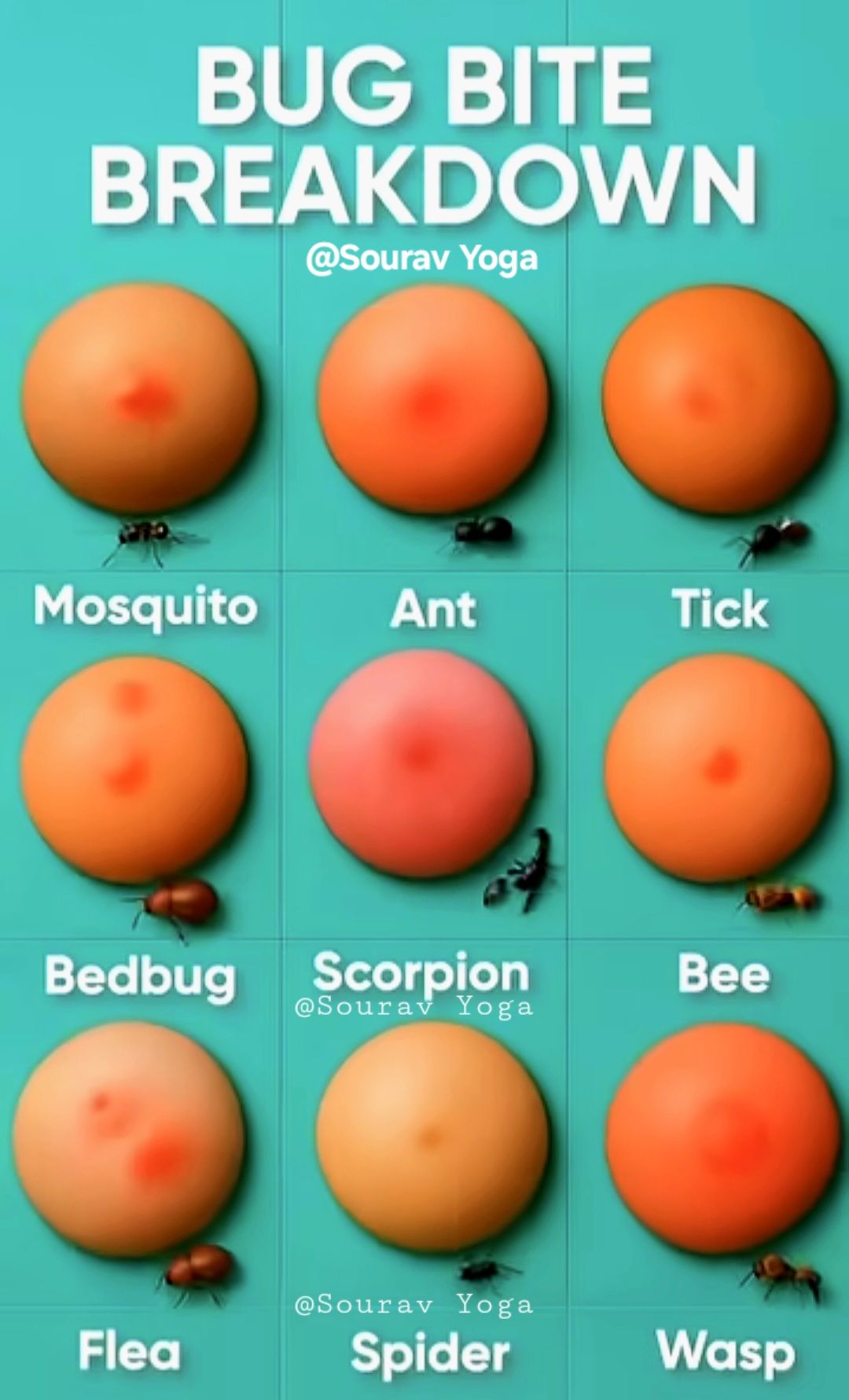 Sourav - BUG BITE BREAKDOWN 101 Ever wondered why some bug bites itch ...