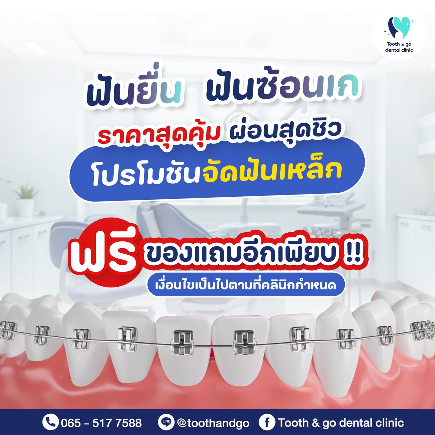Tooth & go dental clinic - คลินิก ทูธแอนด์โก ทำฟัน จัดฟัน จรัญสนิทวงศ์ ...