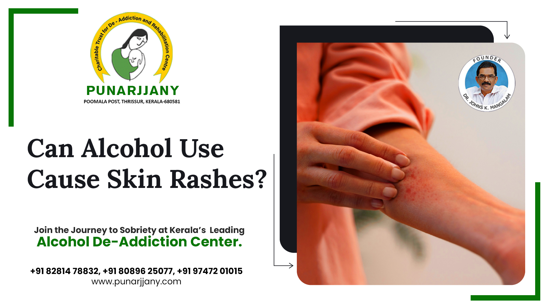 Alcohol use can cause skin rashes. Excessive alcohol consumption can ...