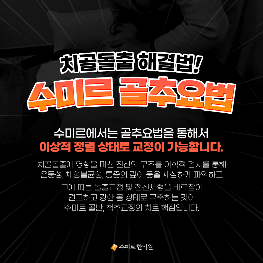 골반미녀 - Y존돌출, 치골돌출, 치구돌출 등등 많은 이름으로 불리는 민망한 Y존 돌출유전이 아닙니다.... | Facebook