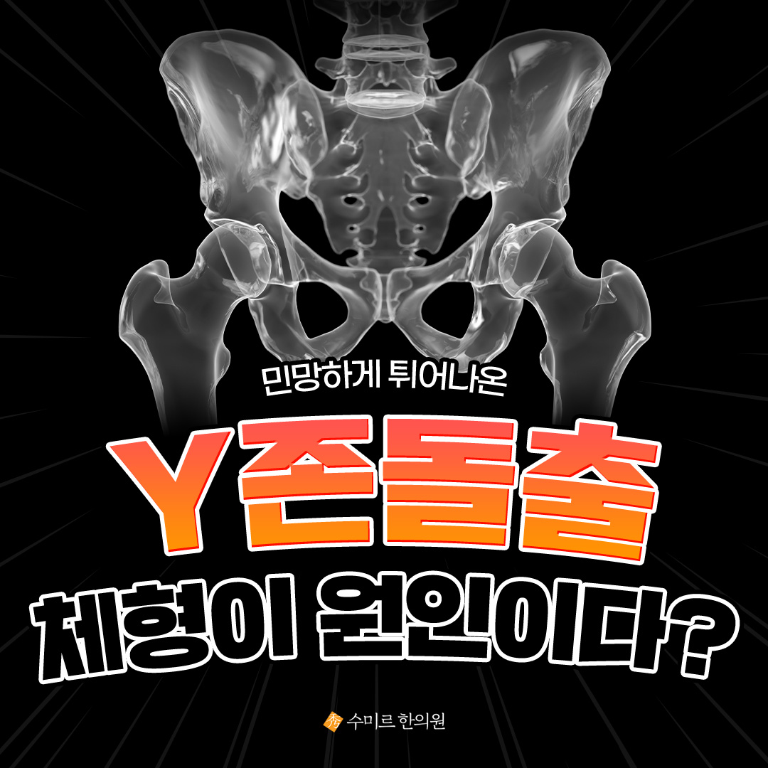 골반미녀 - Y존돌출, 치골돌출, 치구돌출 등등 많은 이름으로 불리는 민망한 Y존 돌출유전이 아닙니다....