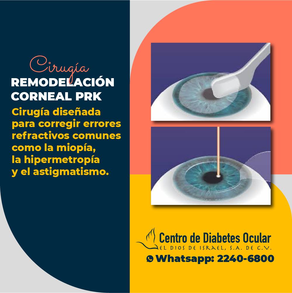 👉🏼💯La cirugía refractiva PRK... - Centro de Diabetes Ocular