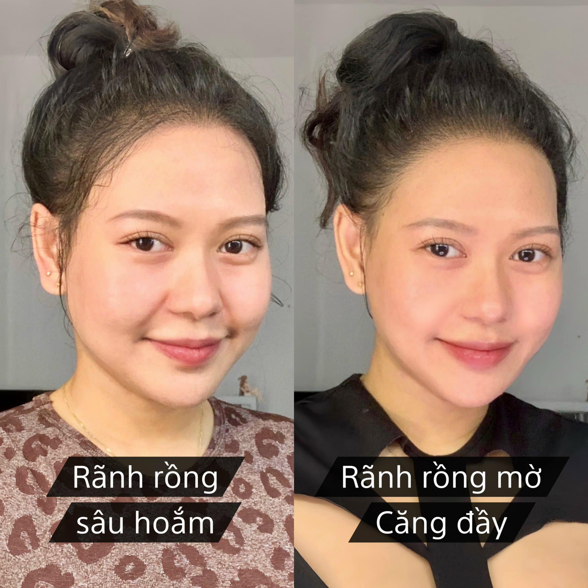 Suzie - Hai cái rãnh rồng nó đầy lên một cách ko thể tin nổi!! Trông ...
