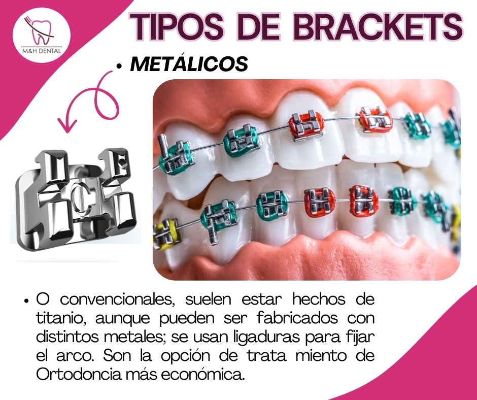 MyH Dental | Mexico City