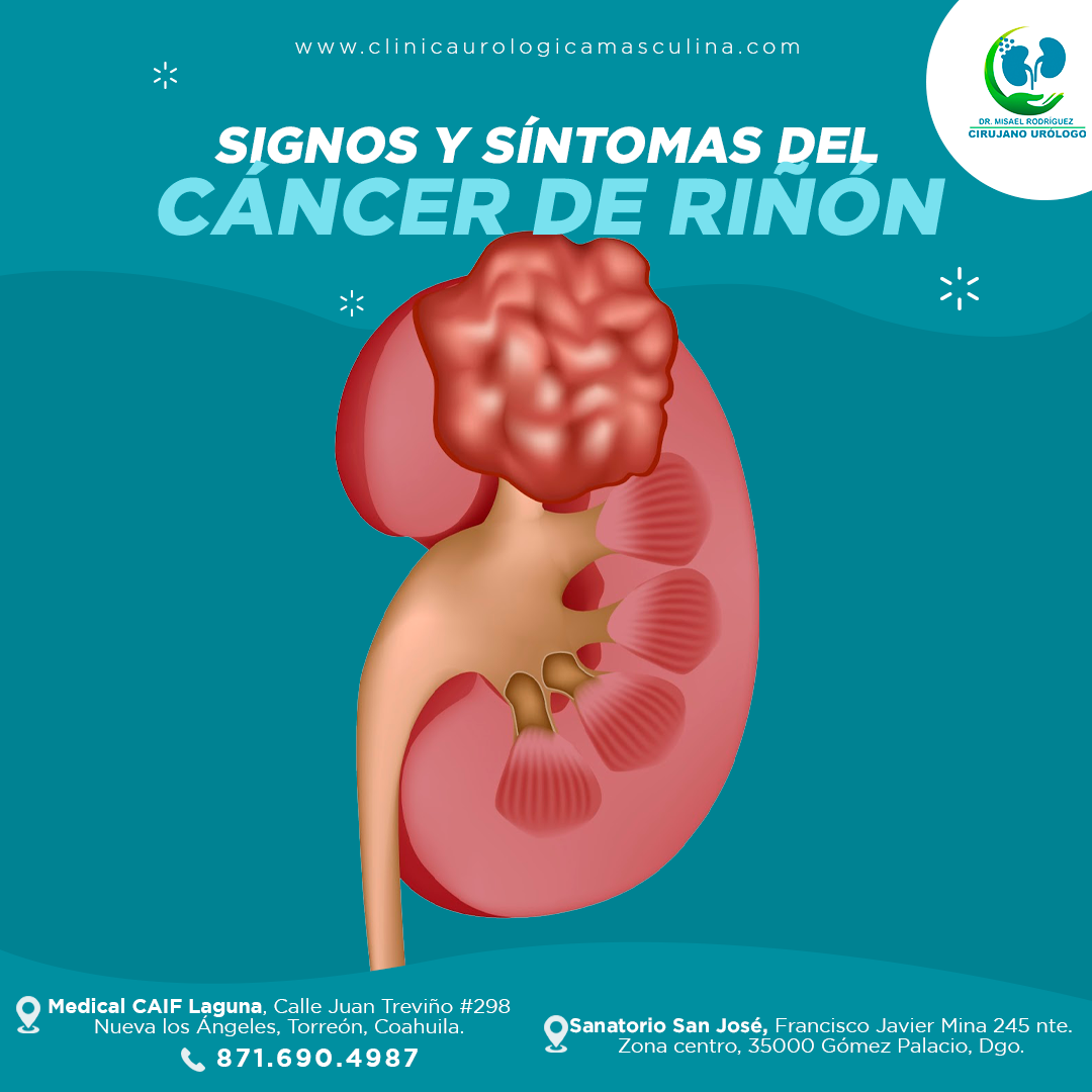 🔺El cáncer de... - Dr Misael Rodríguez -Cirujano Urólogo