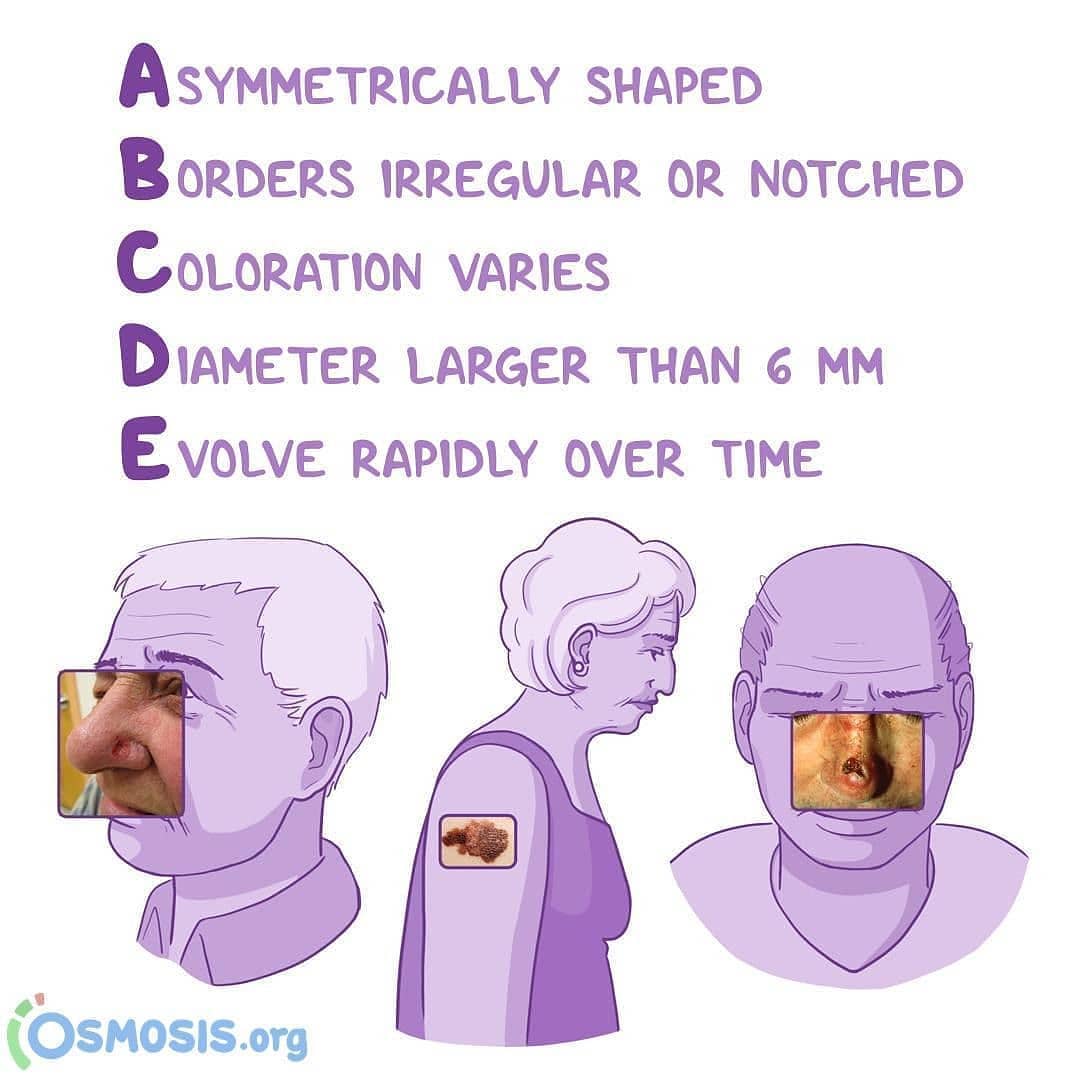 The PA School Prescription - 💥Mnemonic Monday Alert💥 . . The worrisome ...