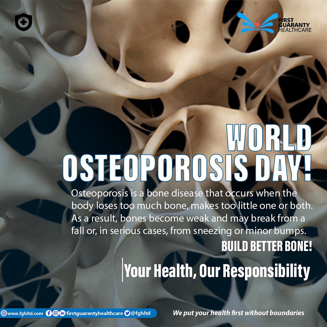 First - Osteoporosis means “porous bone.” Viewed under a microscope ...