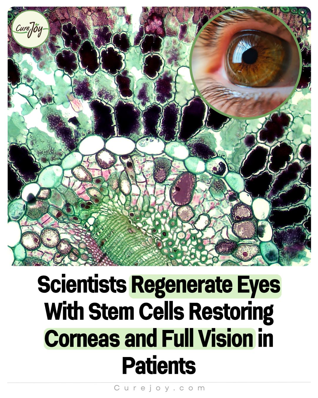 Curejoy - Scientists have unlocked a new way to restore sight—stem ...