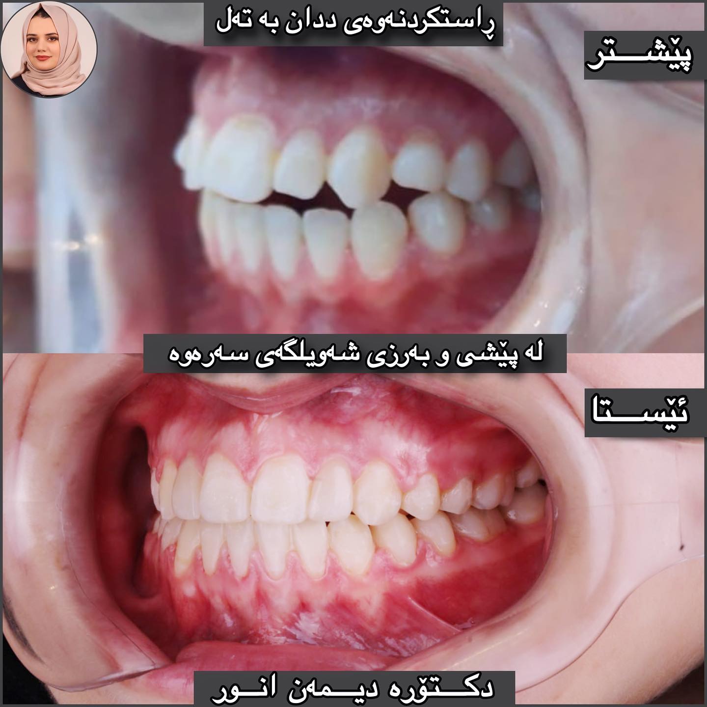 پزیشکی ددان - چارەسەرکردنی کێشەی گەستن و شەویلگە خواری و... | Facebook