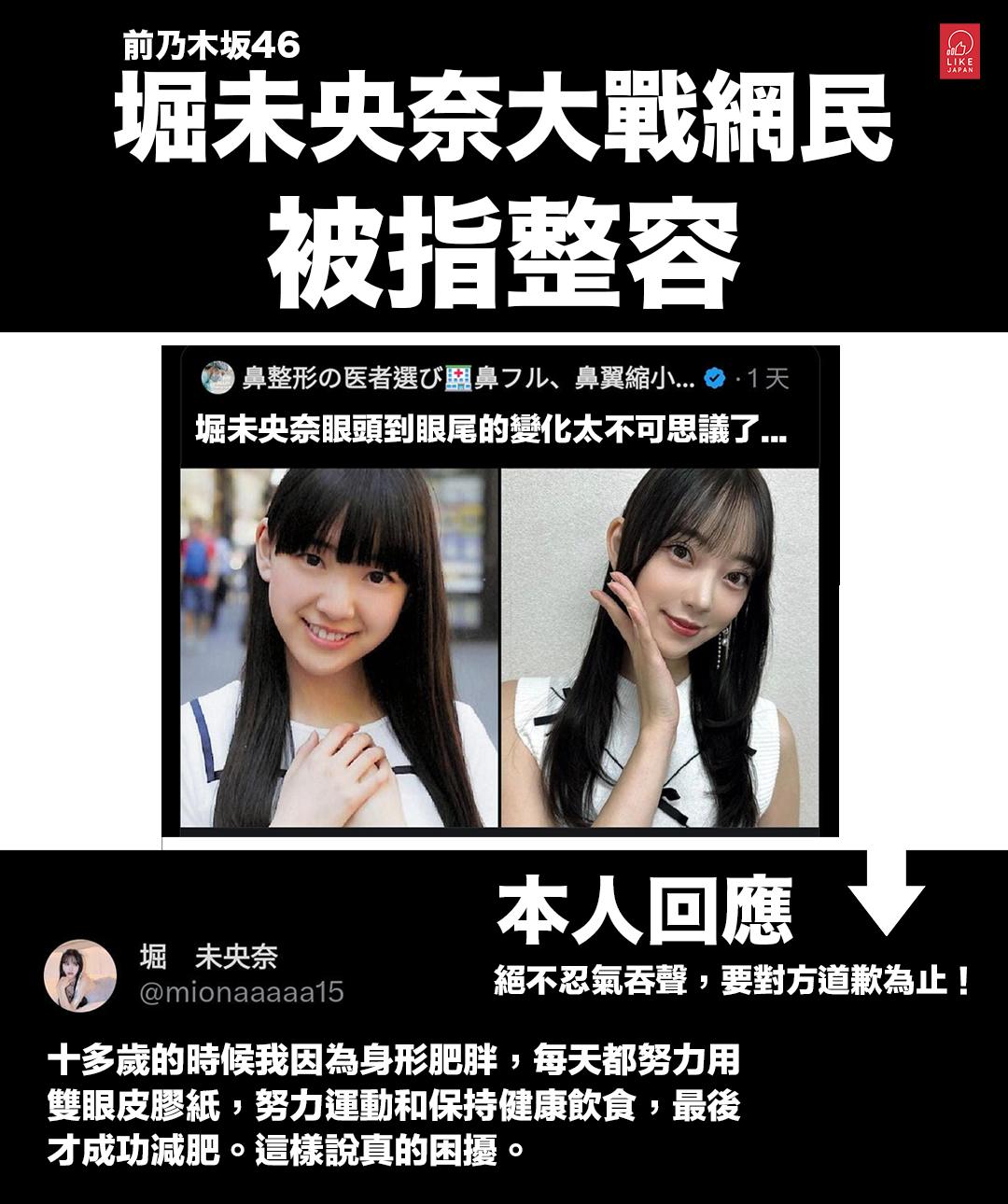 堀 未 央奈 整形