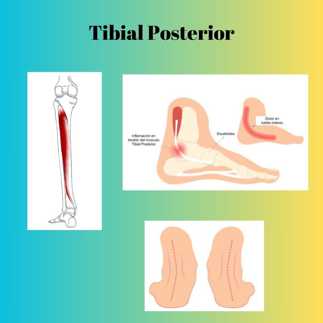 FisioLAR - ¿Qué es el tibial posterior? Se trata de un músculo que ...