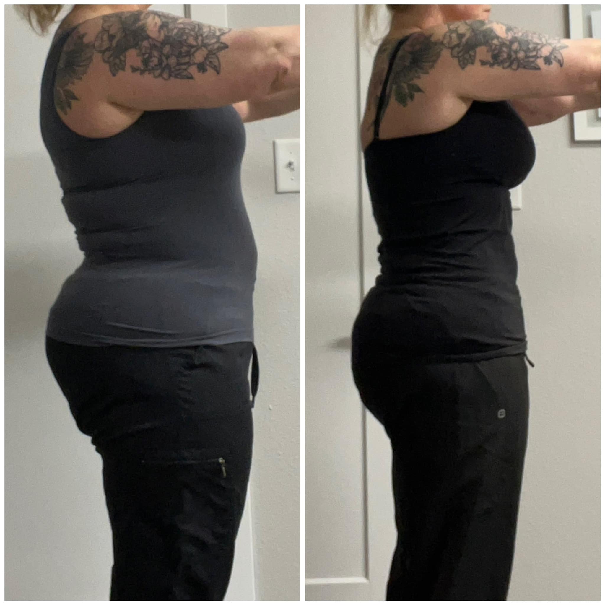 free semaglutide diet Injections Kirkland & Bellevue Ozempic Weight Loss Injections 用量:12.5mg Weight Loss