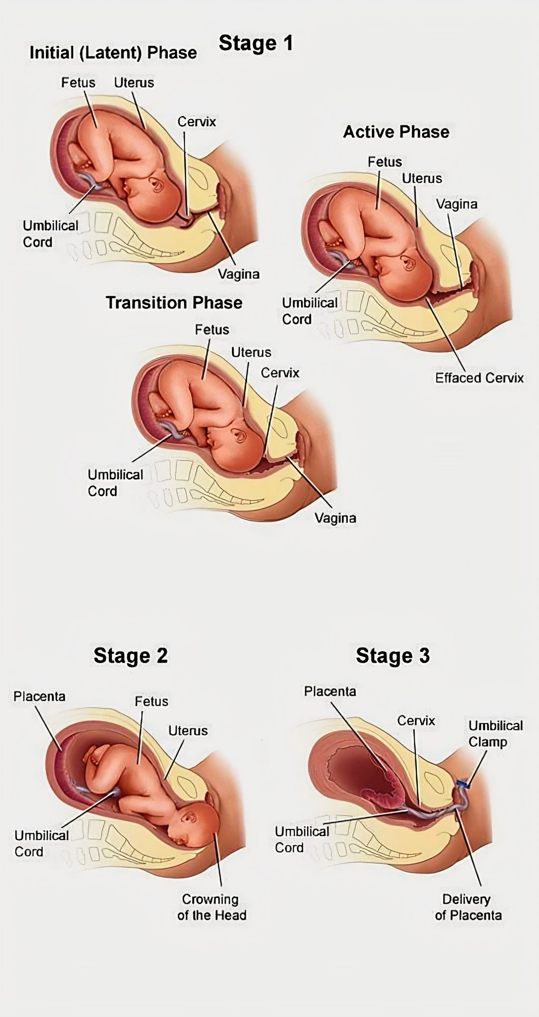 Himanshu - 🤰 The 3 Stages of Labor — A Beautiful Journey of Birth! A ...