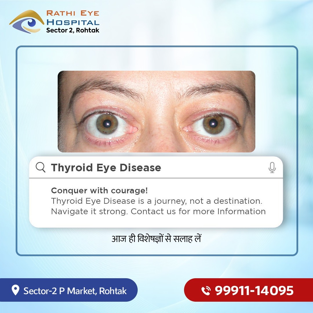 Rathi Eye Hospital Rohtak | Rohtak