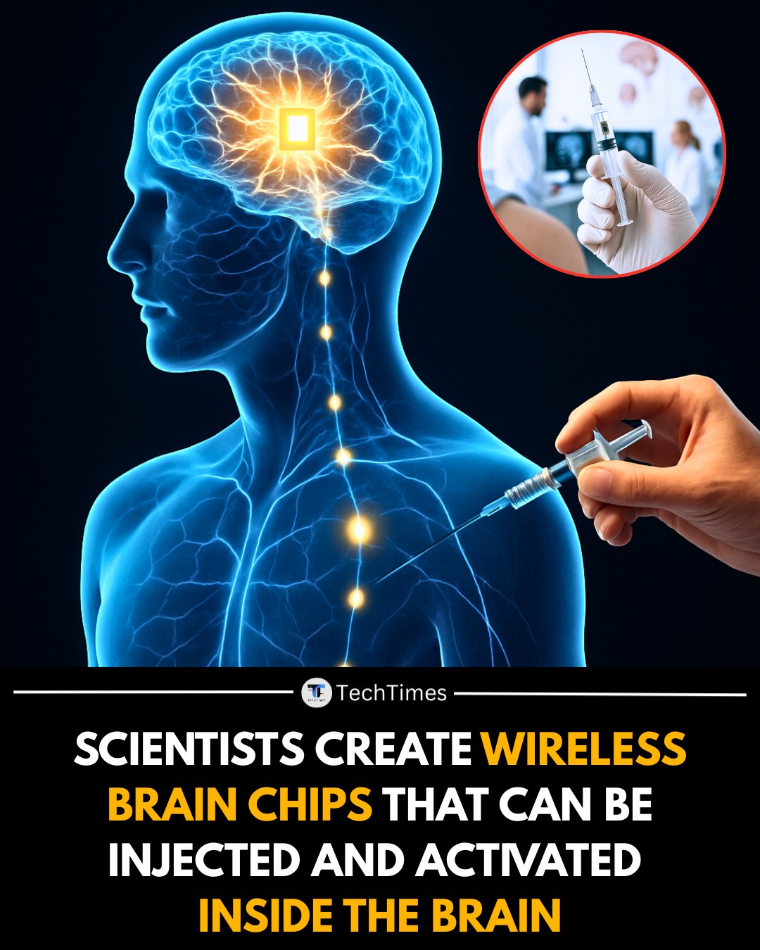 TechTimes - Scientists have developed a new class of wireless brain ...