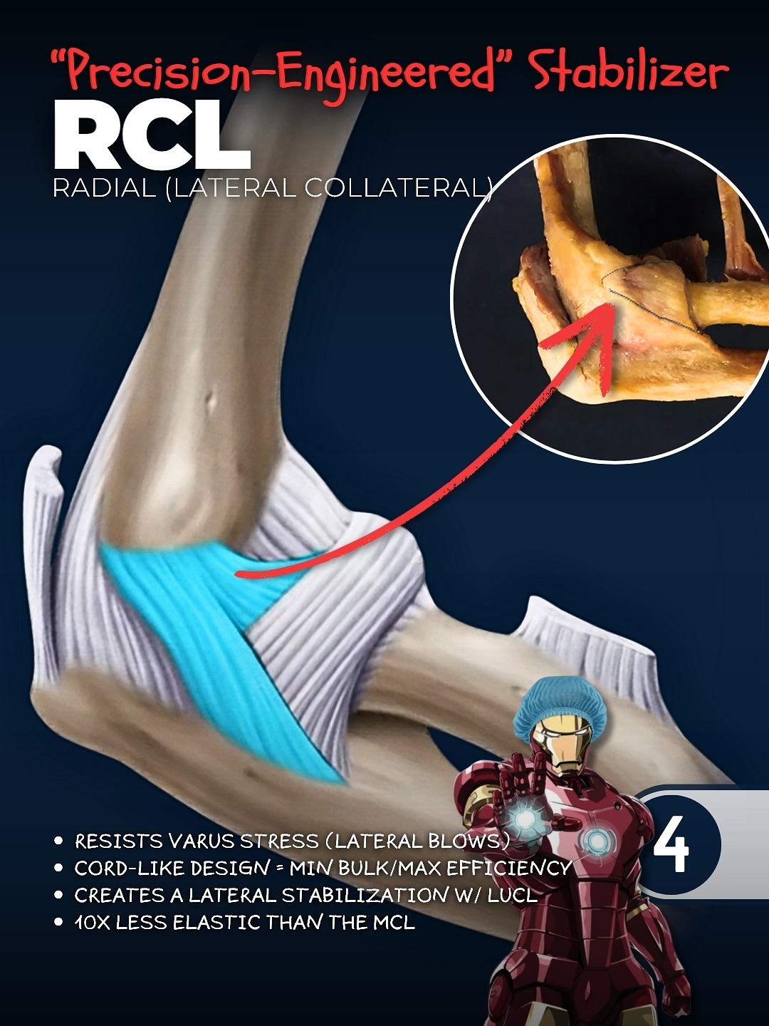 🍦 Slipped Capital Femoral Epiphysis... - Cory Calendine, M.D. | Facebook