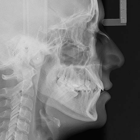 La ortodoncia... - Clínica Odontologica 