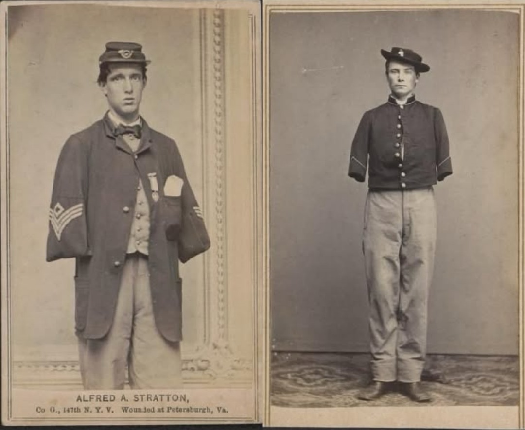 Ancient - During the American Civil War, approximately 60,000 ...