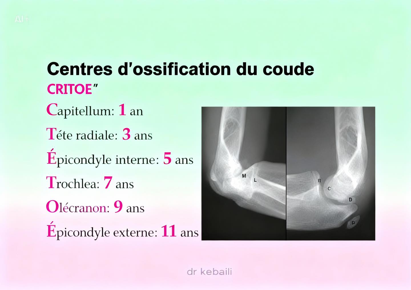 Dr .kebaili - #pediatrie 🦴 CRITOE : un moyen simple pour... | Facebook