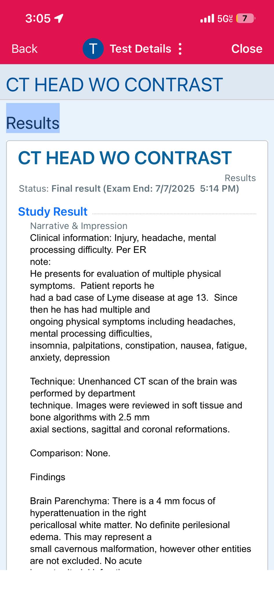 Is cat scan finding related to lyme disease?