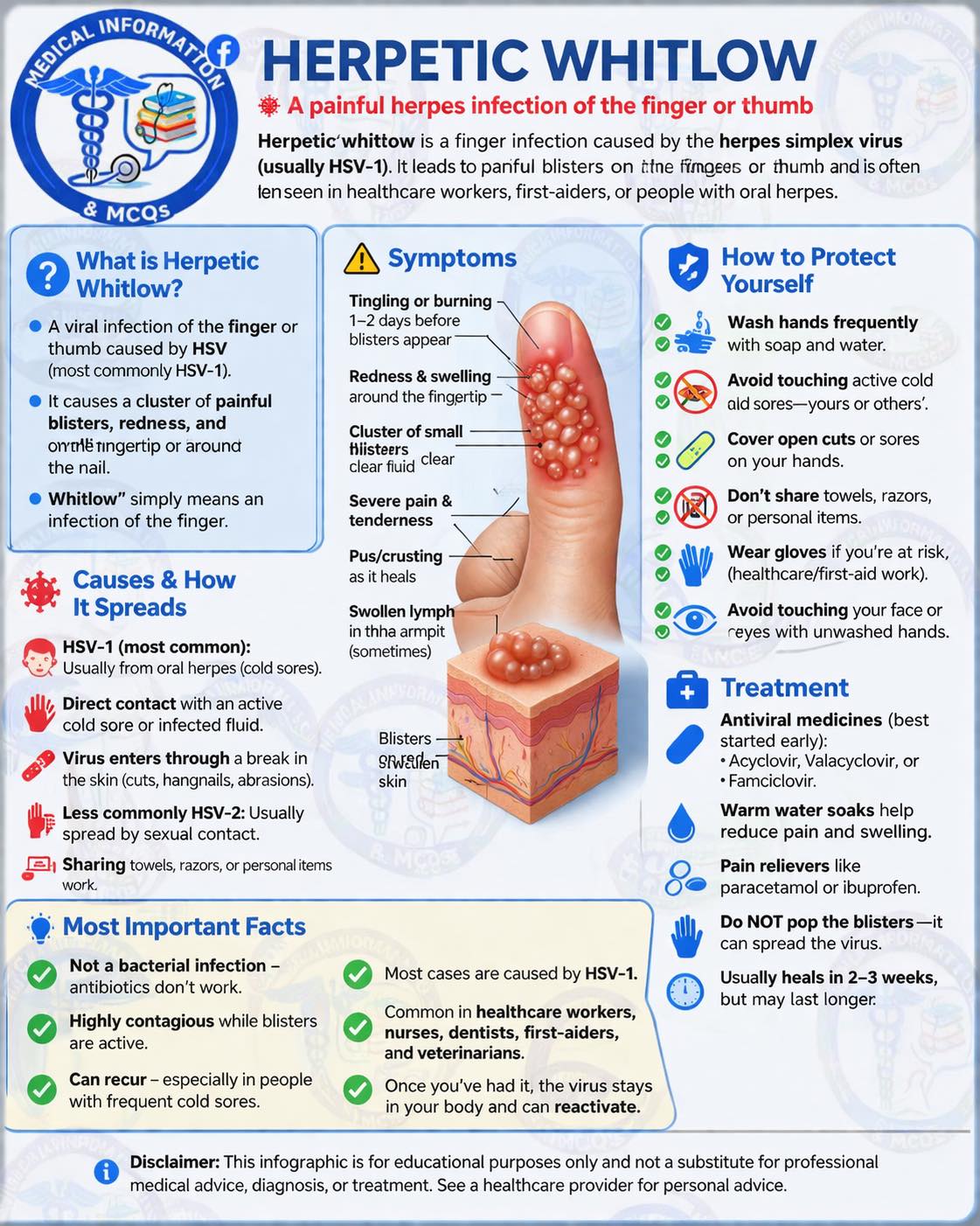 What is herpetic whitlow and how to treat it