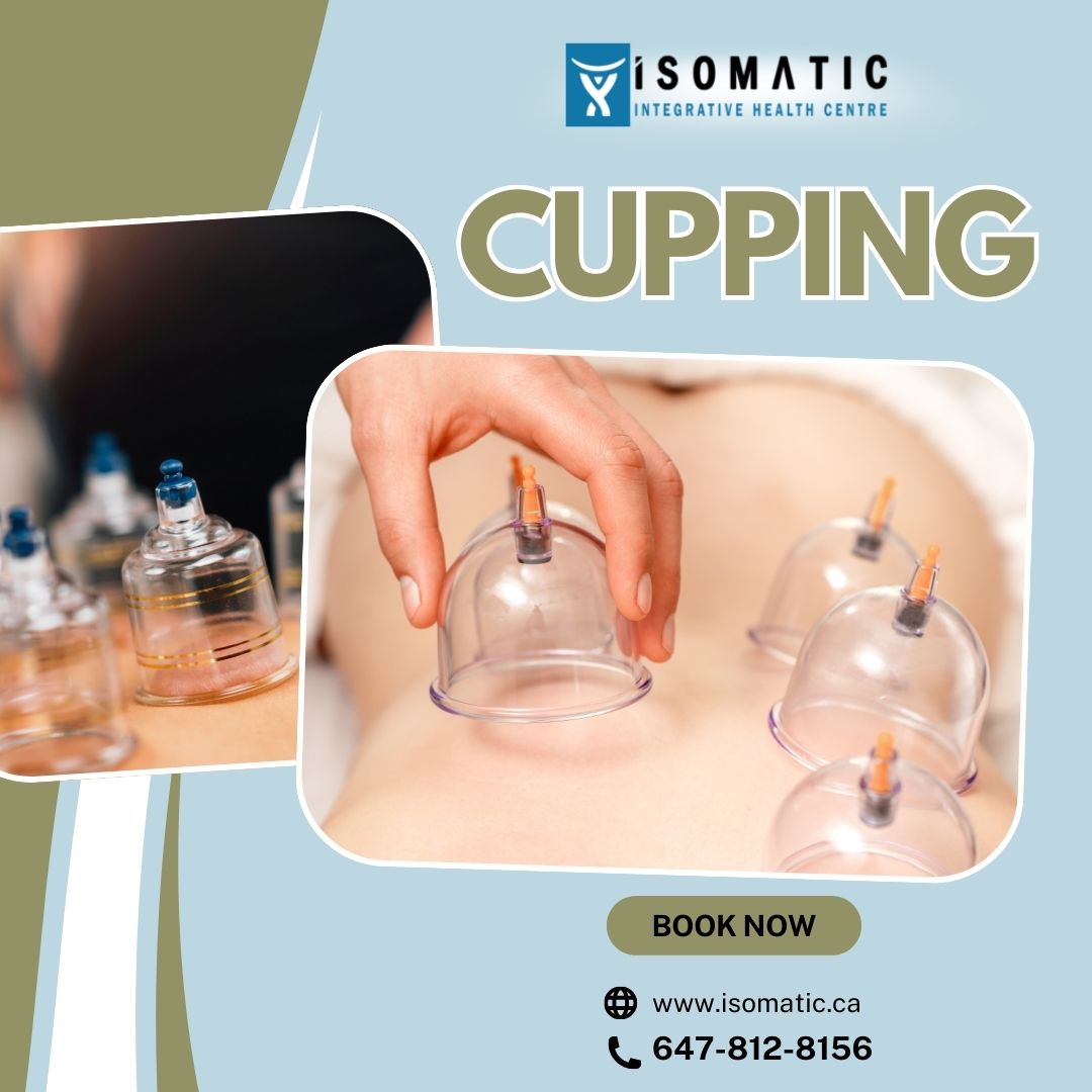 Isomatic - Curious about cupping? Here’s what to expect on your first ...