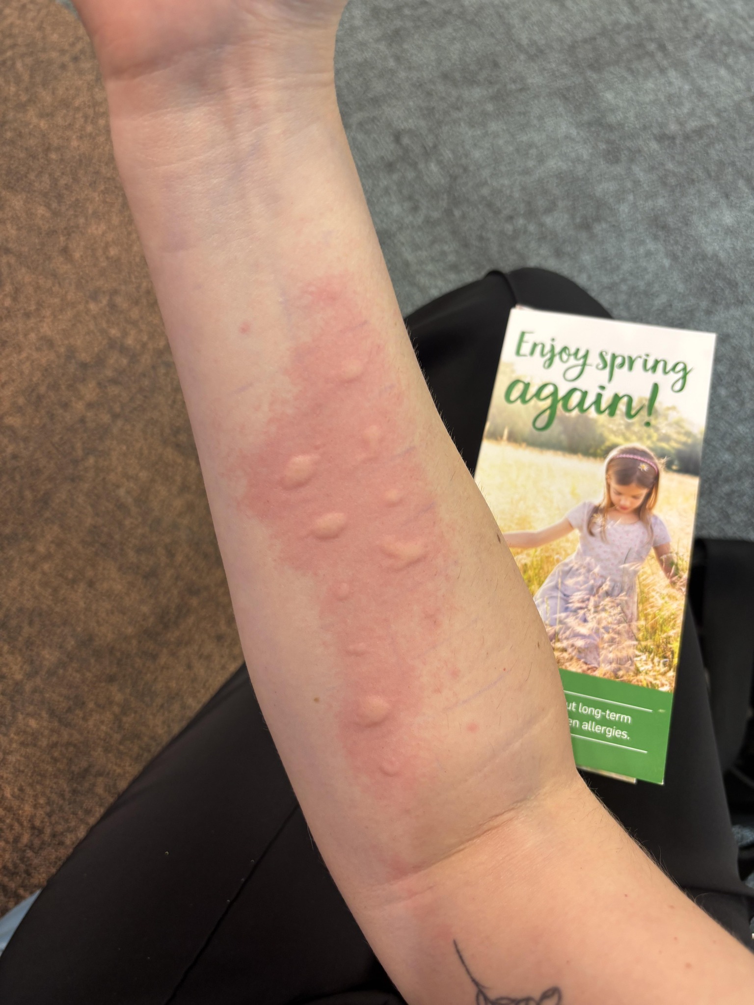 Anything Gone Wrong | Allergy test results - apparently I’m allergic to ...