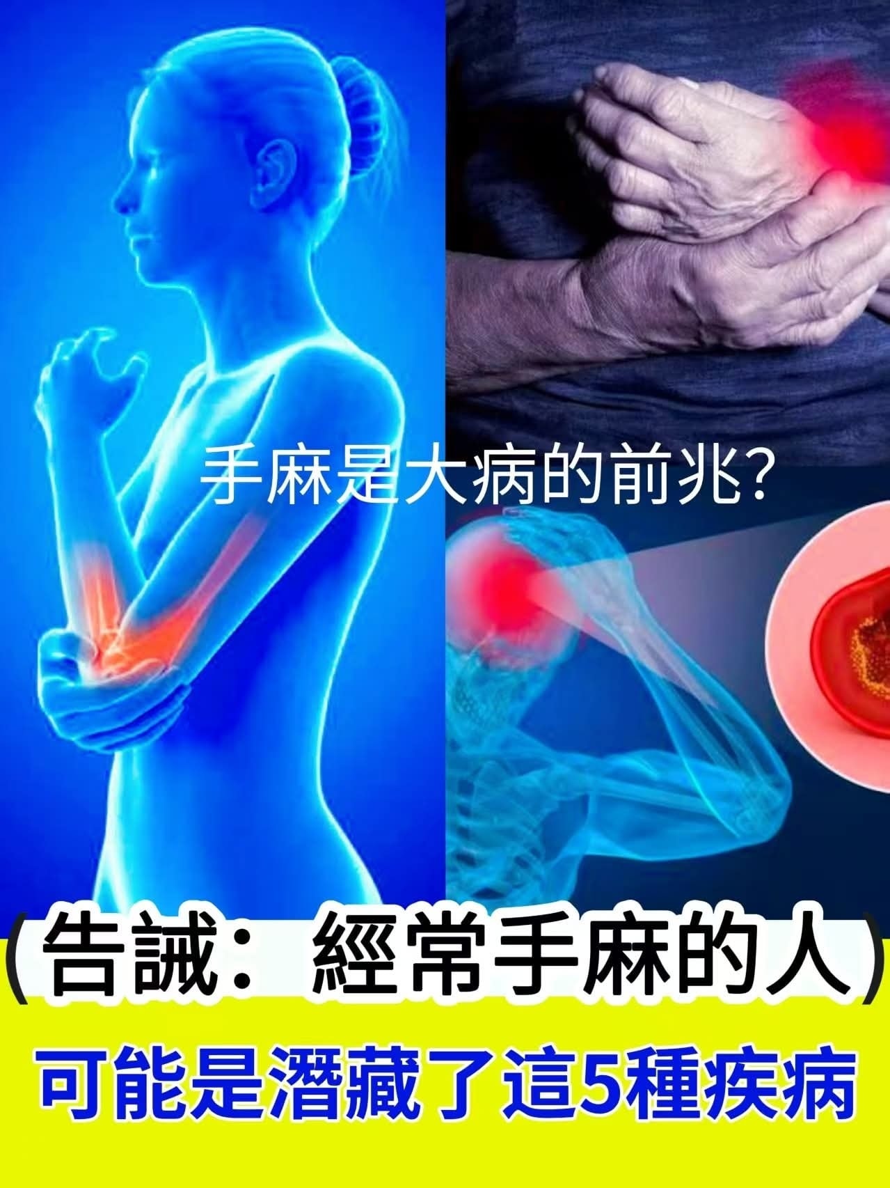 一分钟教你减肥 - 手麻是大病的前兆？告誡：經常手麻的人，可能是潛藏了這5種疾病 | Facebook