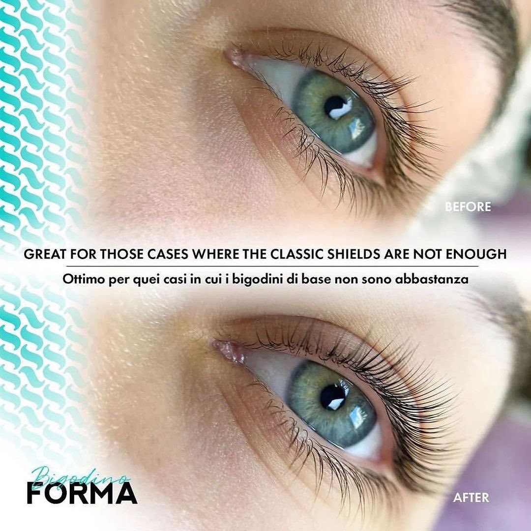 🌟 The fabulous InLei® forma shields! 🌟 🛍️Available for purchase at our ...