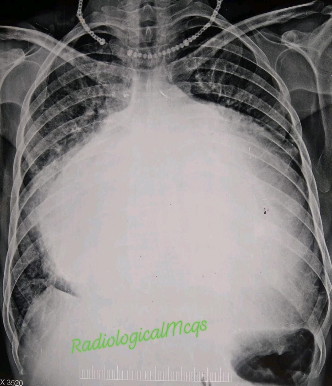 Radiological - Female Patient presents with Shortness of breath and ...
