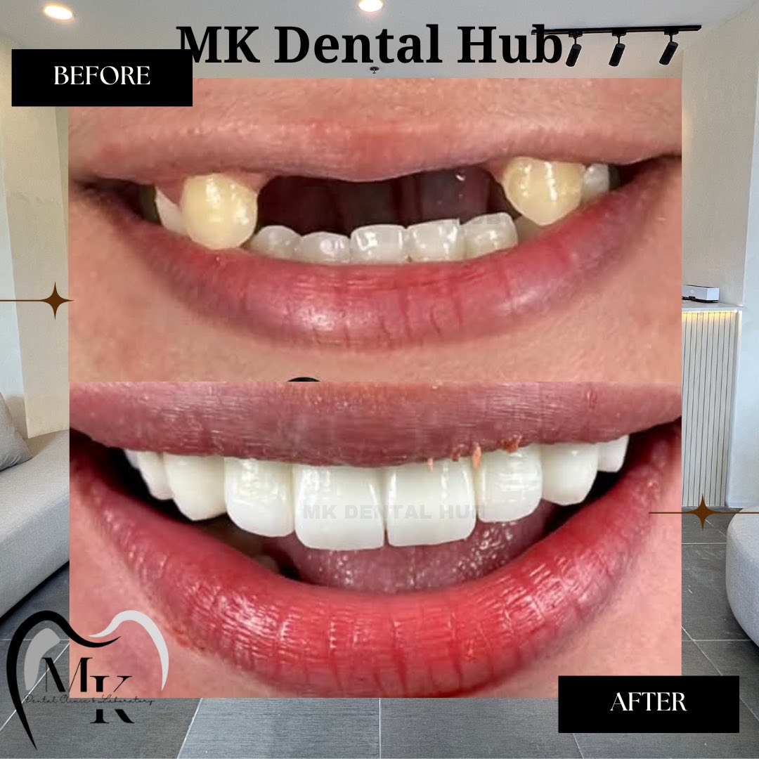 Miggy & Khads Dental Hub | Manila