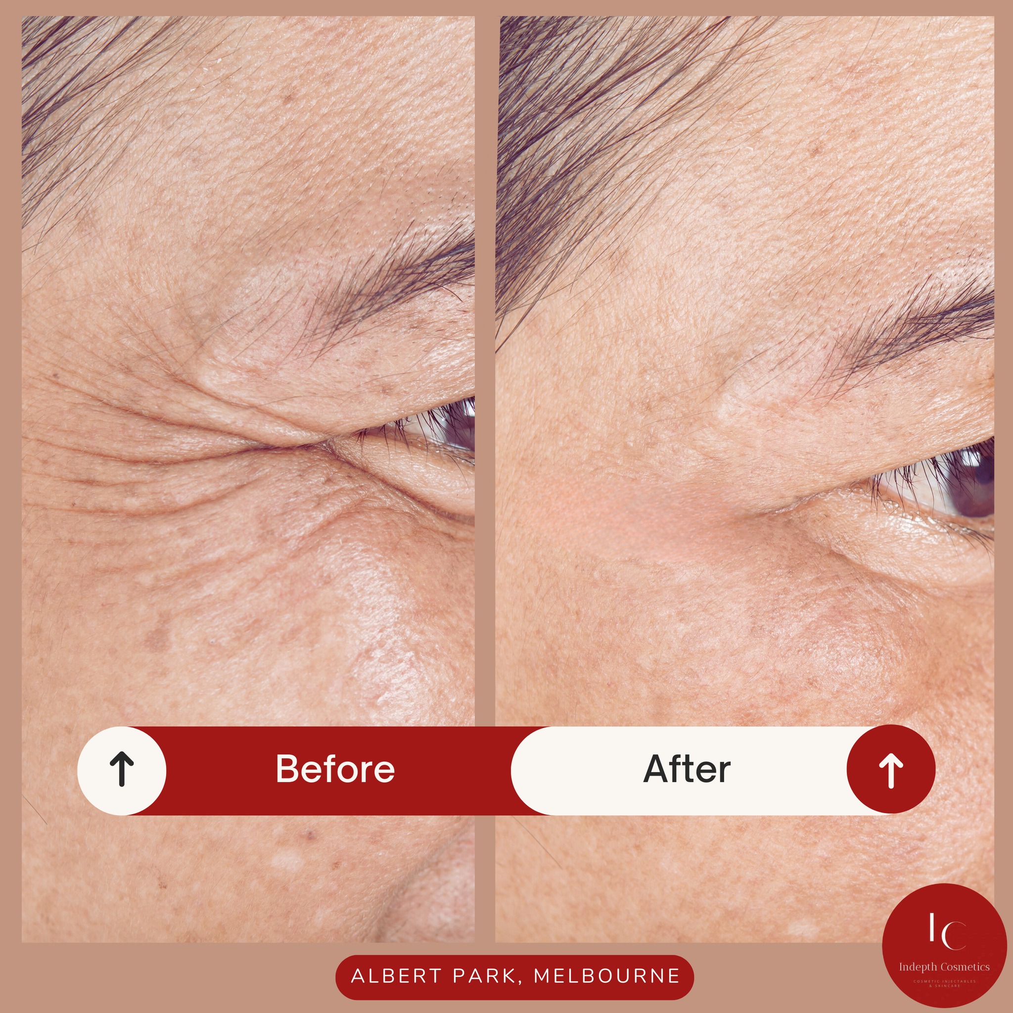 Indepth - Ageing is natural — but so is wanting to feel confident in ...