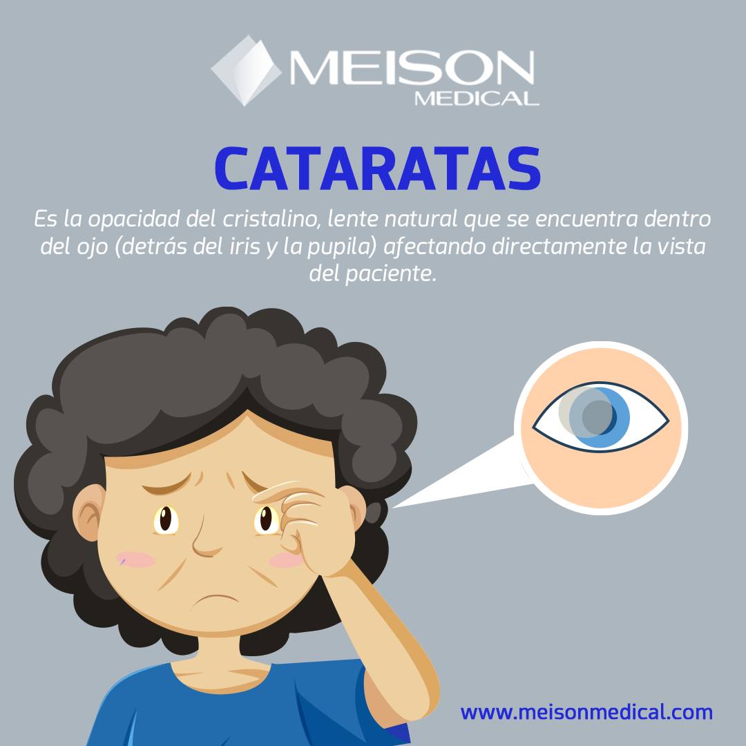 Meison Medical - Sabías que las cataratas afectan...